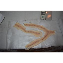 SIX FEET UNDER AUTOPSY Y INCISION STITCHED UP APPLIANCES