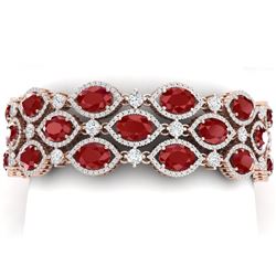 52.84 CTW Royalty Ruby & VS Diamond Bracelet 18K Rose Gold - REF-1181N8Y - 38890
