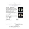 Image 3 : 14KT Yellow Gold Pearl and Diamond Earrings