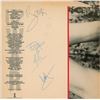 Image 1 : U2