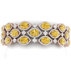 43.84 CTW Royalty Canary Citrine & VS Diamond Bracelet 18K Rose Gold - REF-1018M2F - 38902