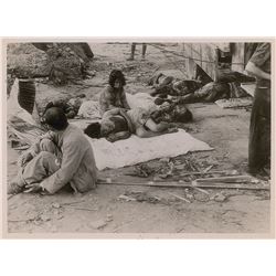 Nagasaki Original Photograph of the Wounded by Yosuke Yamahata