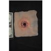 Image 1 : SILICONE IMPALEMENT WOUND 1