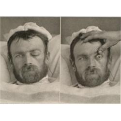 Springer, Julius (Verlag von), EYE EXAMINATION, a heliogravure by Meisenbach Riffarth & Co. Ber...