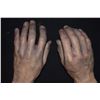 Image 3 : SILICONE ARMS MATCHED PAIR