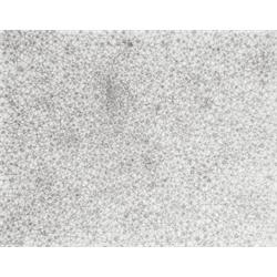 TOM FRIEDMAN (b. 1965) UNTITLED inkjet pri...