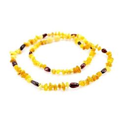 Adult Baltic Cherry Honey Amber Necklace