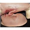 Image 1 : THE KNICK SCREEN USED NOSE GRAFT TO ARM HEAD AND APPLIANCE