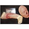 Image 2 : THE KNICK SCREEN USED NOSE GRAFT TO ARM HEAD AND APPLIANCE
