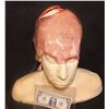 Image 1 : THE KNICK BRAIN SURGERY APPLIANCE WITH SKULL PLATE