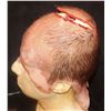 Image 2 : THE KNICK BRAIN SURGERY APPLIANCE WITH SKULL PLATE