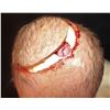 Image 3 : THE KNICK BRAIN SURGERY APPLIANCE WITH SKULL PLATE