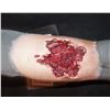 Image 1 : THE KNICK WOUNDED ARM APPLIANCE