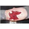 Image 2 : THE KNICK WOUNDED ARM APPLIANCE
