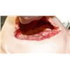 Image 2 : THE KNICK PREGNANT C-SECTION BELLY APPLIANCE