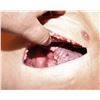 Image 2 : THE NICK SURGERY TORSO REUSABLE