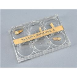 Nathaniel Teager's (Peter LaCroix) Teeth and Dental Container - THE X-FILES (1993 - 2002)