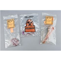 Biohazard Bags With Cancerous Mass, Bone and Blood Sample - THE X-FILES (1993 - 2002)