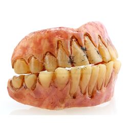 Goblin Teeth Dental Appliances and Case - TRUE BLOOD (2008 - 2014)