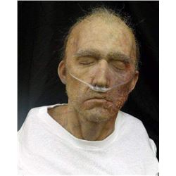 SEVERED SILICONE HEAD BUST WITH DISEASE