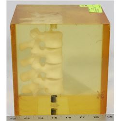 ANTHROPOMORPHIC SPINE PHANTOM MODEL