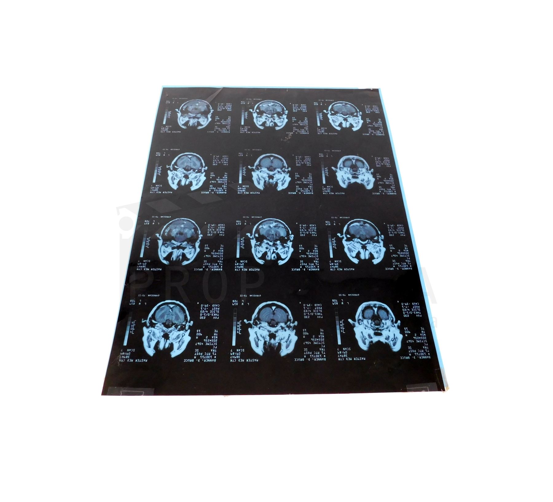 Incredible Hulk - Bruce Banner MRI Scan Prop from Credits Sequence (0011)