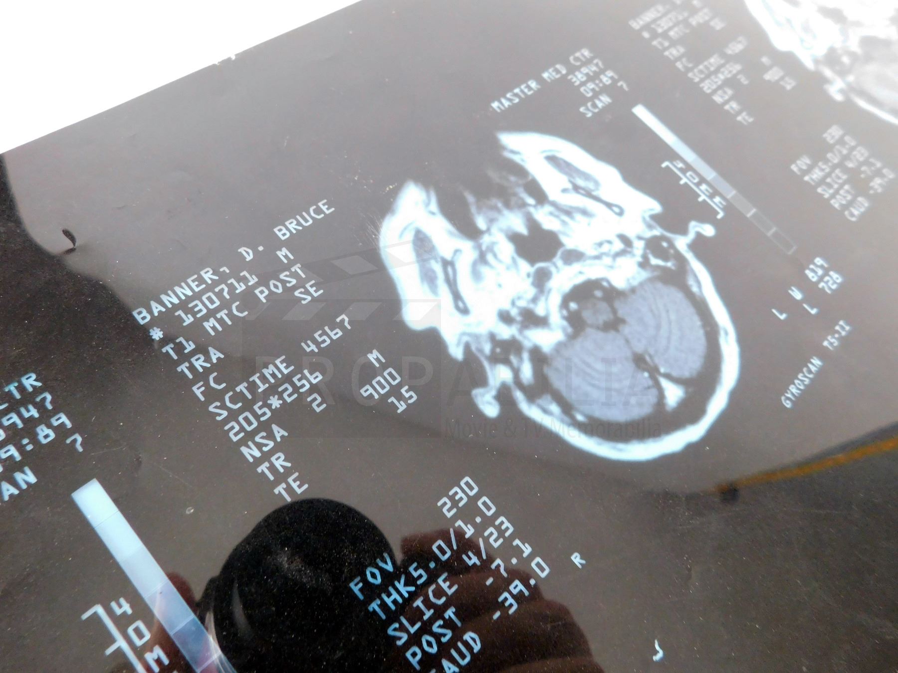 Incredible Hulk - Bruce Banner MRI Scan Prop from Credits Sequence (0011)
