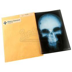 Lot # 227: Frank Castle's Head X-Ray