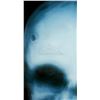 Image 6 : Lot # 227: Frank Castle's Head X-Ray