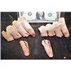 Image 1 : FINGERS PULVERISED IN DOOR AND CUT OFF APPLIANCES