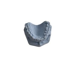 X-Men: The Last Stand  Juggernaut (Vinnie Jones) Dental Casting