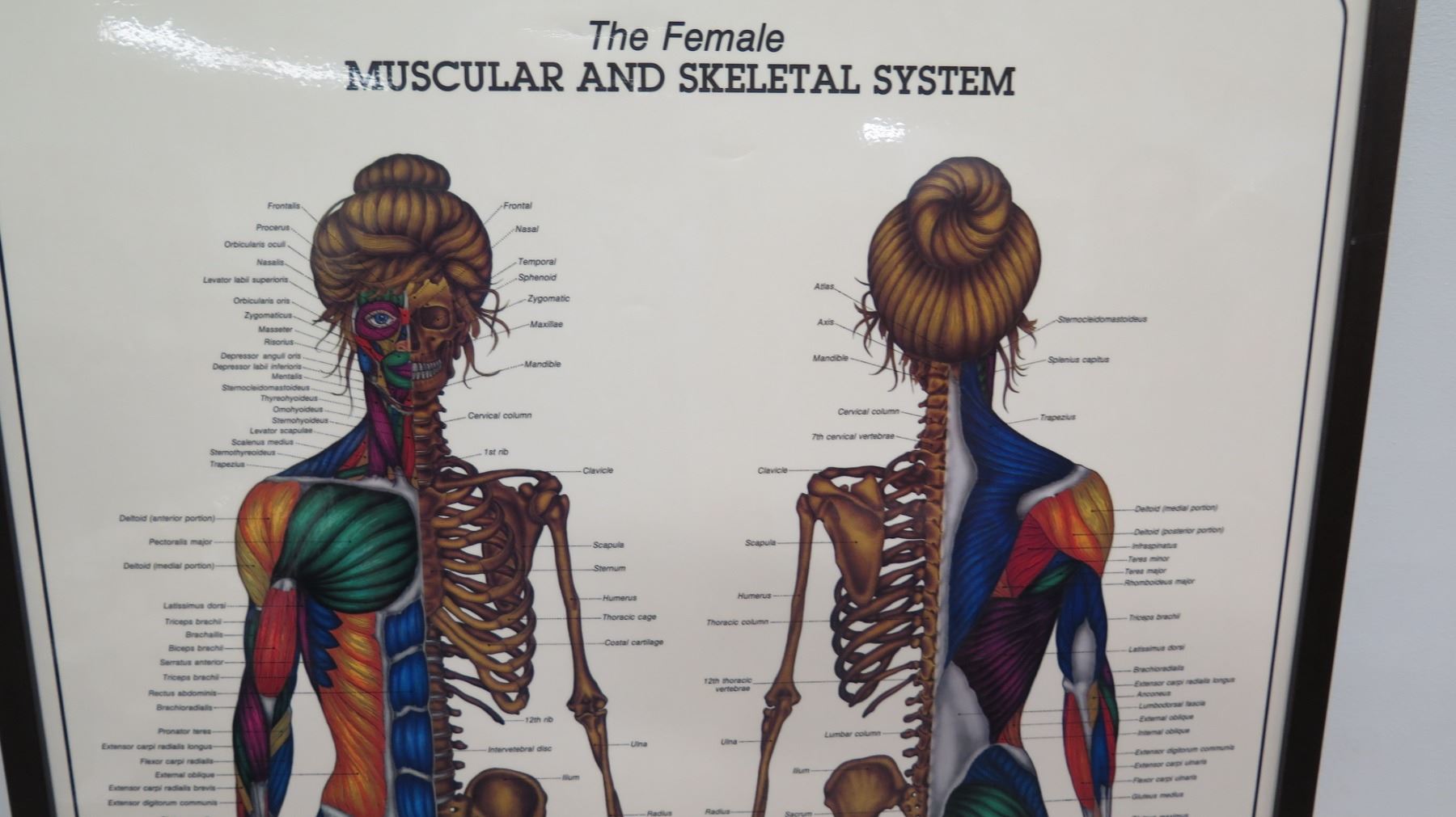 Large Framed Female Muscular Skeletal System By Bruce Aigra 84 Large Framed Female Muscular Skeletal System By Bruce Aigra 84