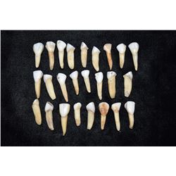 Lot of 25 Buffalo Teeth From the Boley Site Morton Co,