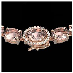 6 ctw Sky Blue Topaz & VS/SI Diamond Earrings 14K Rose Gold