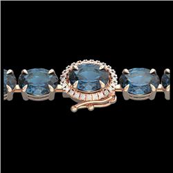 1.50 ctw Intense Blue Diamond Ring 10K Rose Gold