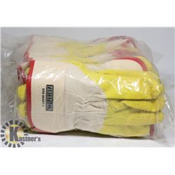 BUNDLE OF 12 NITRO DIPPED