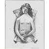 Image 1 : FLETCHER MARTIN, GIRL IN CHAIR, LITHOGRAPH FLETCHER MARTIN (American 1904 - 1979)