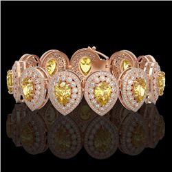 46.44 ctw Canary Citrine & Diamond Victorian Bracelet 14K Rose Gold