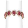 Image 1 : 50.03 ctw Ruby & Diamond Bracelet 18K Rose Gold