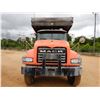 Image 3 : 2013 MACK GU713 Dump Truck