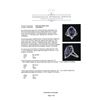 Image 5 : 4.16 ctw Tanzanite and Diamond Ring - 14KT White Gold
