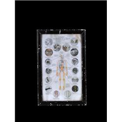 Early 1900's Medical Chart "The Progres