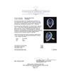 Image 5 : GIA Cert 8.74 ctw Tanzanite and Diamond Ring - 14KT White Gold