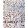 Richmond Burton Monographs