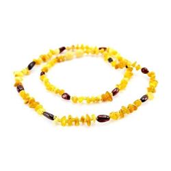 Baltic Cherry & Honey Amber Necklace