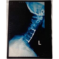 Doctor Strange (2016) - Jonathan Pangborn (Benjamin Bratt) Hero X-Ray