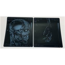 Terminator Salvation (2009) - Cyberdyne Systems Model 101 X-Rays x2