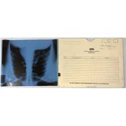 The Rage (2007) - Screen Used X-Ray Prop