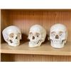 Image 1 : 3 skulls