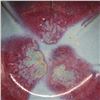 Image 3 : A PURPLE SPLASHED JUNYAO BOWL YUAN DYNASTY 13TH/C.
